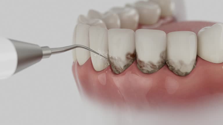 Reliable Dental Implants contractor in Scotia, NY by Smile Center Dentistry